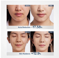 【LIVE】Ulike ReGlow LED Face Mask for TTMKT