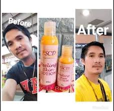 SCD Peeling Skin Lotion 100ml