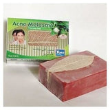 Yoko Acne Melasma Whitening Soap 110gm (Pack of 3) saffronskins.com 